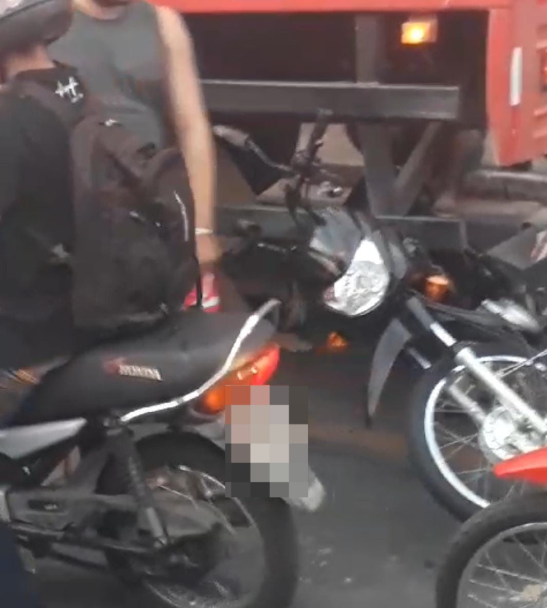 Mulher Fica Em Estado Grave Em Grave Acidente De Moto Em Parna Ba