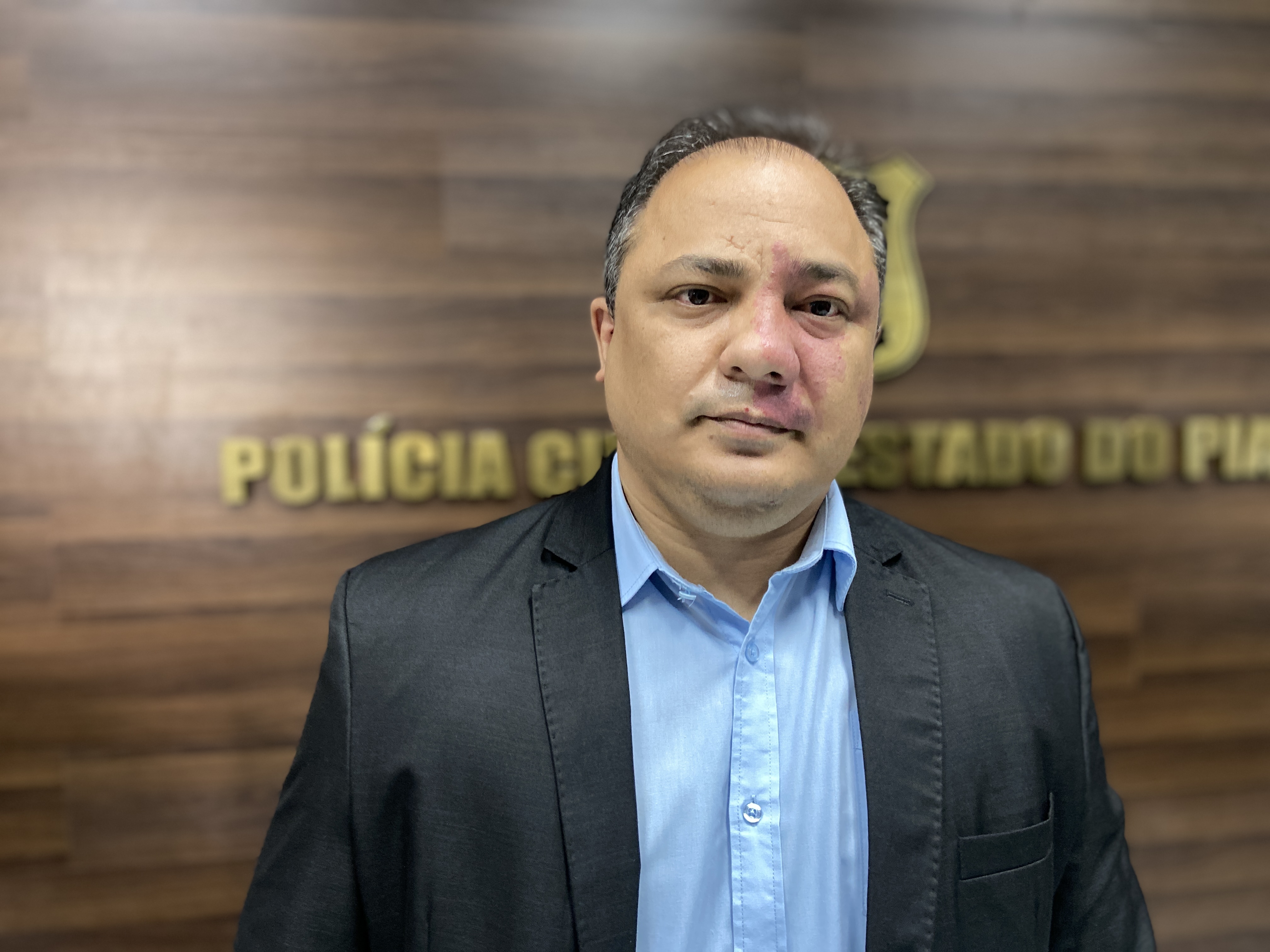 Delegado Geral da Polícia Civil, Luccy Keiko - Foto: Heitor Carvalho/ Lupa1