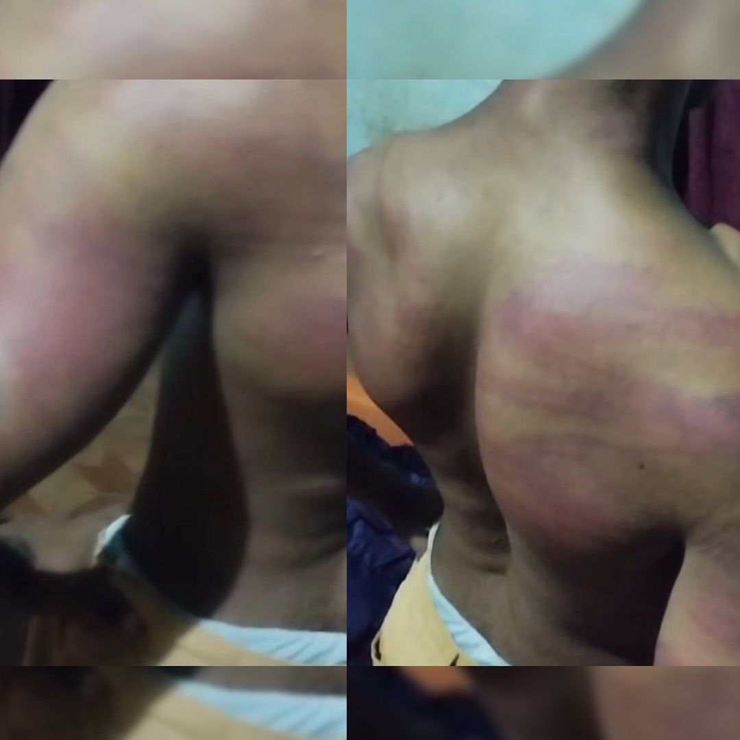 Policiais são suspeitos de agredir jovem quilombola em comunidade do Piauí